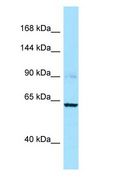CAPN3 / Calpain 3 Antibody - CAPN3 / Calpain 3 antibody Western Blot of OVCAR-3.  This image was taken for the unconjugated form of this product. Other forms have not been tested.