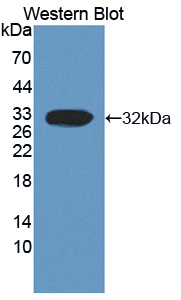 CAPN3 / Calpain 3 Antibody - Western blot of CAPN3 / Calpain 3 antibody.