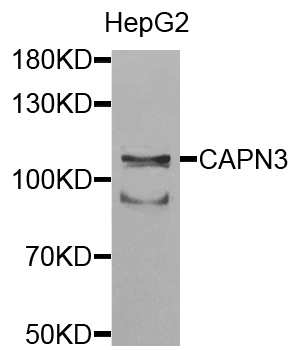 CAPN3 / Calpain 3 Antibody - Western blot analysis of extracts of HepG2 cells.