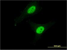CAPN3 / Calpain 3 Antibody - Immunofluorescence of monoclonal antibody to CAPN3 on HeLa cell . [antibody concentration 10 ug/ml]