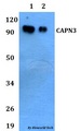 CAPN3 / Calpain 3 Antibody - Western blot of CAPN3 antibody at 1:500 dilution. Lane 1: MCF-7 whole cell lysate. Lane 2: PC12 whole cell lysate.