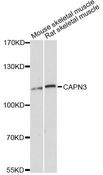 CAPN3 / Calpain 3 Antibody - Western blot analysis of extracts of various cell lines, using CAPN3 Antibody at 1:3000 dilution. The secondary antibody used was an HRP Goat Anti-Rabbit IgG (H+L) at 1:10000 dilution. Lysates were loaded 25ug per lane and 3% nonfat dry milk in TBST was used for blocking. An ECL Kit was used for detection and the exposure time was 90s.