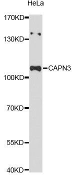 CAPN3 / Calpain 3 Antibody - Western blot analysis of extracts of HeLa cells, using CAPN3 Antibody at 1:3000 dilution. The secondary antibody used was an HRP Goat Anti-Rabbit IgG (H+L) at 1:10000 dilution. Lysates were loaded 25ug per lane and 3% nonfat dry milk in TBST was used for blocking. An ECL Kit was used for detection and the exposure time was 90s.