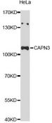CAPN3 / Calpain 3 Antibody - Western blot analysis of extracts of HeLa cells, using CAPN3 Antibody at 1:3000 dilution. The secondary antibody used was an HRP Goat Anti-Rabbit IgG (H+L) at 1:10000 dilution. Lysates were loaded 25ug per lane and 3% nonfat dry milk in TBST was used for blocking. An ECL Kit was used for detection and the exposure time was 90s.