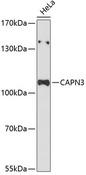CAPN3 / Calpain 3 Antibody - Western blot analysis of extracts of HeLa cells using CAPN3 Polyclonal Antibody at dilution of 1:3000.