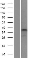 CAPN3 / Calpain 3 Protein - Western validation with an anti-DDK antibody * L: Control HEK293 lysate R: Over-expression lysate