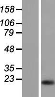 CAPN3 / Calpain 3 Protein - Western validation with an anti-DDK antibody * L: Control HEK293 lysate R: Over-expression lysate