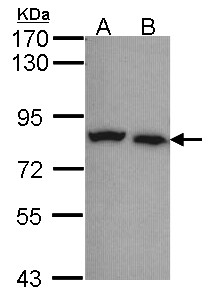 CAPN5 / Calpain 5 Antibody - Sample (30 ug of whole cell lysate). A: A431 , B: H1299. 7.5% SDS PAGE. Calpain-5 antibody. CAPN5 antibody diluted at 1:1000.