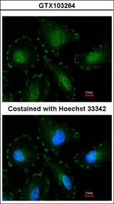CAPN5 / Calpain 5 Antibody - Immunofluorescence of paraformaldehyde-fixed HeLa using Calpain-5 antibody at 1:100 dilution.