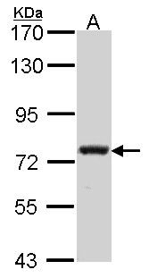 CAPN5 / Calpain 5 Antibody - Sample (30 ug of whole cell lysate). A: A431 . 7.5% SDS PAGE. Calpain 5 antibody. CAPN5 antibody diluted at 1:500.