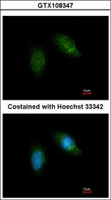 CAPN5 / Calpain 5 Antibody - Immunofluorescence of methanol-fixed HeLa using Calpain 5 antibody at 1:200 dilution.