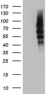 CAPN5 / Calpain 5 Antibody - HEK293T cells were transfected with the pCMV6-ENTRY control. (Left lane) or pCMV6-ENTRY CAPN5. (Right lane) cDNA for 48 hrs and lysed. Equivalent amounts of cell lysates. (5 ug per lane) were separated by SDS-PAGE and immunoblotted with anti-CAPN5.