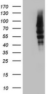CAPN5 / Calpain 5 Antibody - HEK293T cells were transfected with the pCMV6-ENTRY control (Left lane) or pCMV6-ENTRY CAPN5 (Right lane) cDNA for 48 hrs and lysed. Equivalent amounts of cell lysates (5 ug per lane) were separated by SDS-PAGE and immunoblotted with anti-CAPN5.