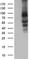 CAPN5 / Calpain 5 Antibody - HEK293T cells were transfected with the pCMV6-ENTRY control. (Left lane) or pCMV6-ENTRY CAPN5. (Right lane) cDNA for 48 hrs and lysed. Equivalent amounts of cell lysates. (5 ug per lane) were separated by SDS-PAGE and immunoblotted with anti-CAPN5.