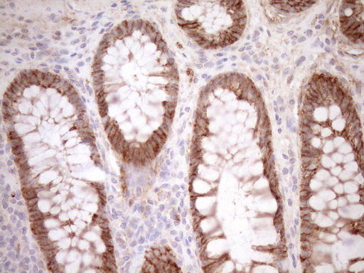 CAPN5 / Calpain 5 Antibody - Immunohistochemical staining of paraffin-embedded Human colon tissue within the normal limits using anti-CAPN5 mouse monoclonal antibody. (Heat-induced epitope retrieval by 1mM EDTA in 10mM Tris buffer. (pH8.5) at 120°C for 3 min. (1:150)