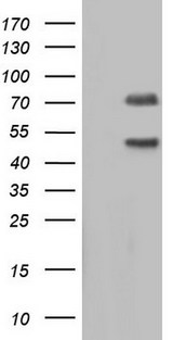 CAPN5 / Calpain 5 Antibody - HEK293T cells were transfected with the pCMV6-ENTRY control (Left lane) or pCMV6-ENTRY CAPN5 (Right lane) cDNA for 48 hrs and lysed. Equivalent amounts of cell lysates (5 ug per lane) were separated by SDS-PAGE and immunoblotted with anti-CAPN5.