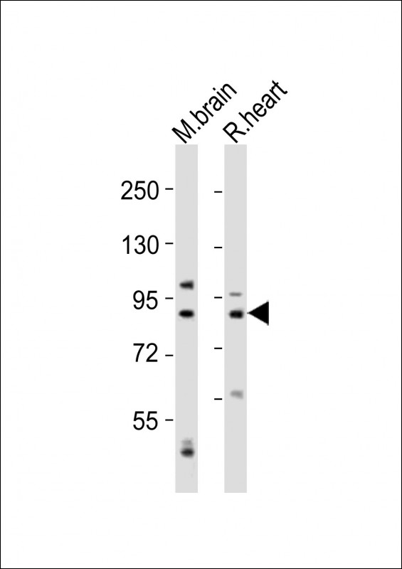 CAPN5 / Calpain 5 Antibody - All lanes : Anti-CAPN5 Antibody at 1:2000 dilution Lane 1: mouse brain lysates Lane 2: rat heart lysates Lysates/proteins at 20 ug per lane. Secondary Goat Anti-Rabbit IgG, (H+L), Peroxidase conjugated at 1/10000 dilution Predicted band size : 73 kDa Blocking/Dilution buffer: 5% NFDM/TBST.