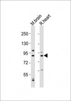 CAPN5 / Calpain 5 Antibody - All lanes : Anti-CAPN5 Antibody at 1:2000 dilution Lane 1: mouse brain lysates Lane 2: rat heart lysates Lysates/proteins at 20 ug per lane. Secondary Goat Anti-Rabbit IgG, (H+L), Peroxidase conjugated at 1/10000 dilution Predicted band size : 73 kDa Blocking/Dilution buffer: 5% NFDM/TBST.