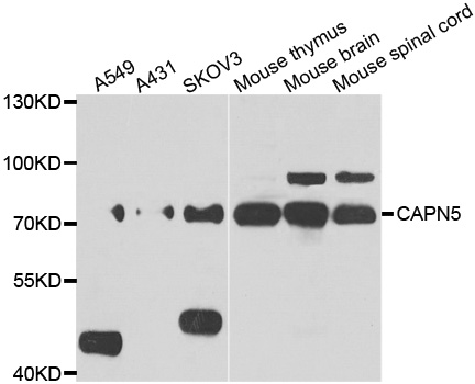 CAPN5 / Calpain 5 Antibody - Western blot analysis of extracts of various cell lines.