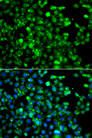 CAPN5 / Calpain 5 Antibody - Immunofluorescence analysis of A549 cells.
