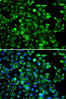 CAPN5 / Calpain 5 Antibody - Immunofluorescence analysis of A549 cells.
