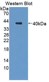 CAPN5 / Calpain 5 Antibody