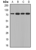 CAPN5 / Calpain 5 Antibody - Western blot analysis of Calpain 5 expression in A431 (A); SKOV3 (B); mouse thymus (C); mouse brain (D) whole cell lysates.