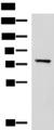 CAPN5 / Calpain 5 Antibody - Western blot analysis of Mouse brain tissue lysate  using CAPN5 Polyclonal Antibody at dilution of 1:550