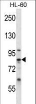 CAPN6 / Calpain 6 Antibody - CAPN6 Antibody western blot of HL-60 cell line lysates (35 ug/lane). The CAPN6 antibody detected the CAPN6 protein (arrow).