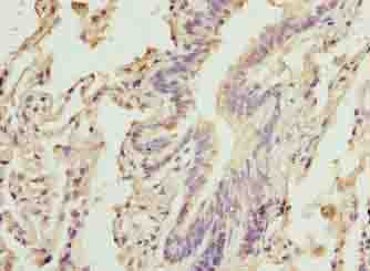 CAPN6 / Calpain 6 Antibody - Immunohistochemistry of paraffin-embedded human lung tissue using antibody at dilution of 1:100.