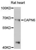 CAPN6 / Calpain 6 Antibody - Western blot analysis of extracts of rat heart, using CAPN6 antibody at 1:3000 dilution. The secondary antibody used was an HRP Goat Anti-Rabbit IgG (H+L) at 1:10000 dilution. Lysates were loaded 25ug per lane and 3% nonfat dry milk in TBST was used for blocking. An ECL Kit was used for detection and the exposure time was 90s.