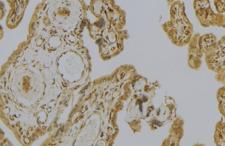 CAPN6 / Calpain 6 Antibody - 1:100 staining mouse placenta tissue by IHC-P. The sample was formaldehyde fixed and a heat mediated antigen retrieval step in citrate buffer was performed. The sample was then blocked and incubated with the antibody for 1.5 hours at 22°C. An HRP conjugated goat anti-rabbit antibody was used as the secondary.