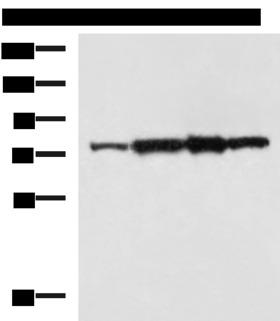CAPN6 / Calpain 6 Antibody - Western blot analysis of Rat heart tissue A172 cell NIH/3T3 cell TM4 cell lysates  using CAPN6 Polyclonal Antibody at dilution of 1:800