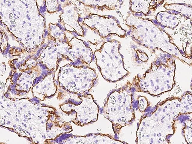 CAPN6 / Calpain 6 Antibody - Immunochemical staining of human CAPN6 in human placenta with rabbit polyclonal antibody at 1:1000 dilution, formalin-fixed paraffin embedded sections.