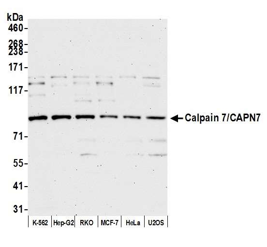 CAPN7 / Calpain 7 Antibody - Detection of human Calpain 7/CAPN7 by western blot. Samples: Whole cell lysate (5 µg) from K-562, Hep-G2, RKO, MCF-7, HeLa, and U2OS cells prepared using NETN lysis buffer. Antibody: Affinity purified Rabbit anti-Calpain 7/CAPN7 antibody used for WB at 1:1000. Detection: Chemiluminescence with an exposure time of 75 seconds.