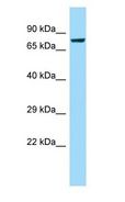 CAPN8 / Calpain 8 Antibody - CAPN8 / Calpain 8 antibody Western Blot of HeLa.  This image was taken for the unconjugated form of this product. Other forms have not been tested.
