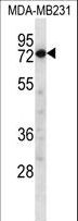 CAPN8 / Calpain 8 Antibody - CAPN8 Antibody western blot of MDA-MB231 cell line lysates (35 ug/lane). The CAPN8 antibody detected the CAPN8 protein (arrow).