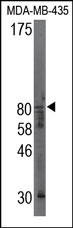 CAPN9 / Calpain 9 Antibody - The Calpain-9 Antibody is used in Western blot to detect Calpain-9 in MDA-MB-435 cell lysate.