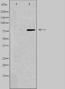 CAPN9 / Calpain 9 Antibody - Western blot analysis of extracts of HuvEc cells using CAPN9 antibody. The lane on the left is treated with the antigen-specific peptide.