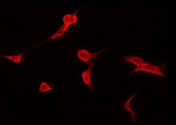 CAPN9 / Calpain 9 Antibody - Staining HuvEc cells by IF/ICC. The samples were fixed with PFA and permeabilized in 0.1% Triton X-100, then blocked in 10% serum for 45 min at 25°C. The primary antibody was diluted at 1:200 and incubated with the sample for 1 hour at 37°C. An Alexa Fluor 594 conjugated goat anti-rabbit IgG (H+L) Ab, diluted at 1/600, was used as the secondary antibody.