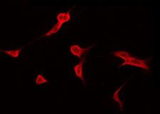 CAPN9 / Calpain 9 Antibody - Staining HuvEc cells by IF/ICC. The samples were fixed with PFA and permeabilized in 0.1% Triton X-100, then blocked in 10% serum for 45 min at 25°C. The primary antibody was diluted at 1:200 and incubated with the sample for 1 hour at 37°C. An Alexa Fluor 594 conjugated goat anti-rabbit IgG (H+L) Ab, diluted at 1/600, was used as the secondary antibody.