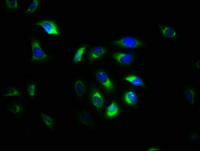 CAPNS1 / CAPN4 Antibody - Immunofluorescence staining of A549 cells with CAPNS1 Antibody at 1:533, counter-stained with DAPI. The cells were fixed in 4% formaldehyde, permeabilized using 0.2% Triton X-100 and blocked in 10% normal Goat Serum. The cells were then incubated with the antibody overnight at 4°C. The secondary antibody was Alexa Fluor 488-congugated AffiniPure Goat Anti-Rabbit IgG(H+L).