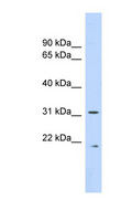 CAPNS1 / CAPN4 Antibody - CAPNS1 / Calpain S1 antibody Western blot of Fetal Lung lysate. This image was taken for the unconjugated form of this product. Other forms have not been tested.