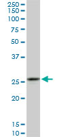 CAPNS1 / CAPN4 Antibody - Western blot of CAPNS1 expression in PC-12 cell lysate.