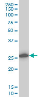 CAPNS1 / CAPN4 Antibody - Western blot of CAPNS1 expression in A-431 cell lysate.