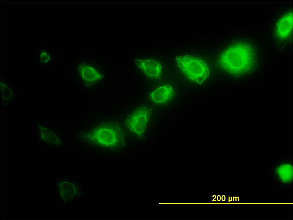 CAPNS1 / CAPN4 Antibody - Immunofluorescence of monoclonal antibody to CAPNS1 on HeLa cell. [antibody concentration 20 ug/ml]