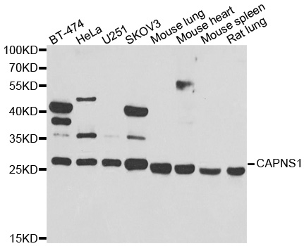 CAPNS1 / CAPN4 Antibody - Western blot analysis of extracts of various cell lines.