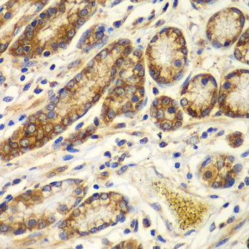 CAPNS1 / CAPN4 Antibody - Immunohistochemistry of paraffin-embedded human colon tissue.