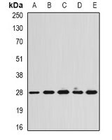 CAPNS1 / CAPN4 Antibody - Western blot analysis of Calpain reg expression in HeLa (A); SKOV3 (B); mouse heart (C); mouse spleen (D); rat lung (E) whole cell lysates.