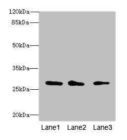 CAPNS1 / CAPN4 Antibody - Western blot All Lanes: CAPNS1antibody at 1.15ug/ml Lane 1 : Mouse lung tissue Lane 2 : Mouse brain tissue Lane 3 : Hela whole cell lysate Secondary Goat polyclonal to Rabbit IgG at 1/10000 dilution Predicted band size: 28 kDa Observed band size: 28 kDa